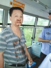四川资阳一乘客为提前下车打断公交司机鼻梁(
